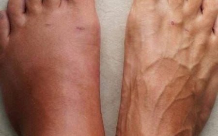 Hier sind die 6 Symptome