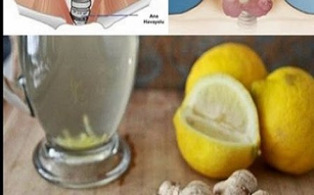 Die Mischung aus Ingwer und Zitrone regt die Fettverbrennung an und liefert Vitamine und Nährstoffe