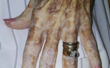 Eine Krankenschwester machte ein Foto von einer älteren Frau, das schnell viral ging. Die Geschichte berührte viele Menschen und verbreitete eine starke Botschaft über Lebenserfahrung und Selbstakzeptanz.