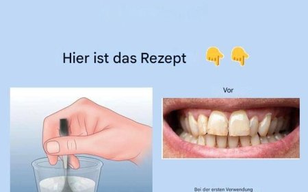 Entfernen Sie Zahnstein und bleichen Sie Ihre Zähne mit diesem einfachen Rezept.