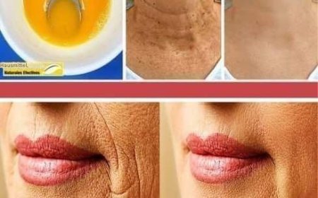 Ich habe es getan und niemand hat es geglaubt: Diese Creme hilft Ihnen in wenigen Tagen bei Falten und Hautunreinheiten