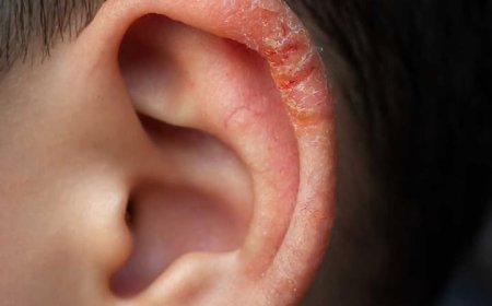 Der Arzttermin ist in einer Woche. Was kann ich tun