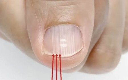 Was die vertikalen Linien auf Ihren Nägeln wirklich verratenn