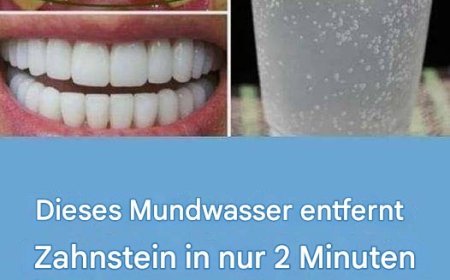 So bekommen Sie weiße Zähne: 15 Tipps für ein schönes Lächeln