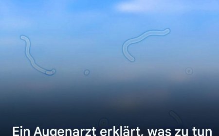 Was sind Mouches volantes? Das sollten Sie tun, wenn Sie sie sehen