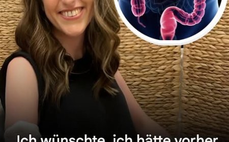 Eine Frau mit Darmkrebs teilt 4 Symptome, auf die man achten sollte