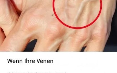 Wenn Sie sichtbare Venen haben, bedeutet das, dass Sie