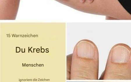 15 Warnzeichen