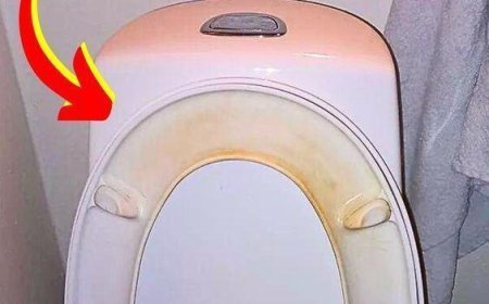 Der Trick, um gelbe Flecken auf dem WC-Sitz zu entfernen