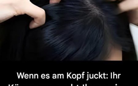 Juckt Ihre Kopfhaut? Hier sind die Hauptursachen.