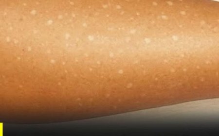 Weiße Flecken auf der Haut: Welche Vitaminmängel könnten die Ursache sein