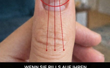 Linien auf Ihren Fingernägeln: Was sie über Ihre Gesundheit verraten könnten