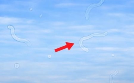 Glaskörpertrübungen verstehen: Ursachen, Symptome und hilfreiche Tipps