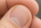 Dieses kleine Tierchen wurde im Haar entdeckt – doch was ist es wirklich?