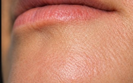 Kinnbehaarung bei Frauen: Mögliche Ursachen und was Sie darüber wissen sollten