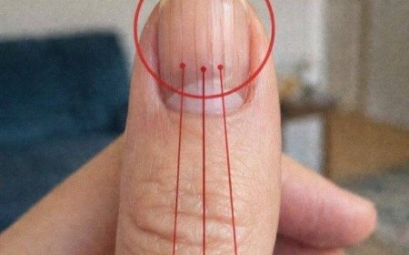 Rillen auf den Fingernägeln: Was dahinterstecken kann – und wann man genauer hinschauen sollte